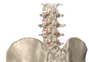 back pain, back pain relief, back pain remedy, back pain therapy back pain specialist back pain treatments back pain clinic chiropractic chiropractic clinics chiropracter chiropractic care chiropractic adjustments spinal decompression spinal decompression Sarasota, Tampa Chiropractor, Tampa Chiropractic, Chiropractor Sarasota, Chiropractic Sarasota, chiropractor florida, chiropractor in florida, Sarasota chiropractic, chiropractor, Florida chiropractic ,fl chiropractic new york, bradenton Chiropractor