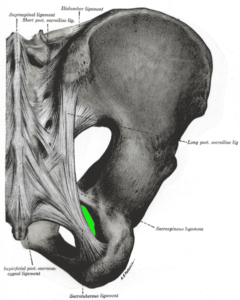 Sciatic Nerve Pain, sciatic nerve pain relief, sciatic nerve pain treatment